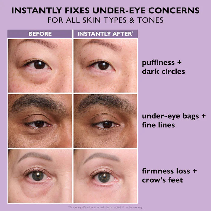 Instant FIRMx for Firming Under-Eye Bags & Wrinkles